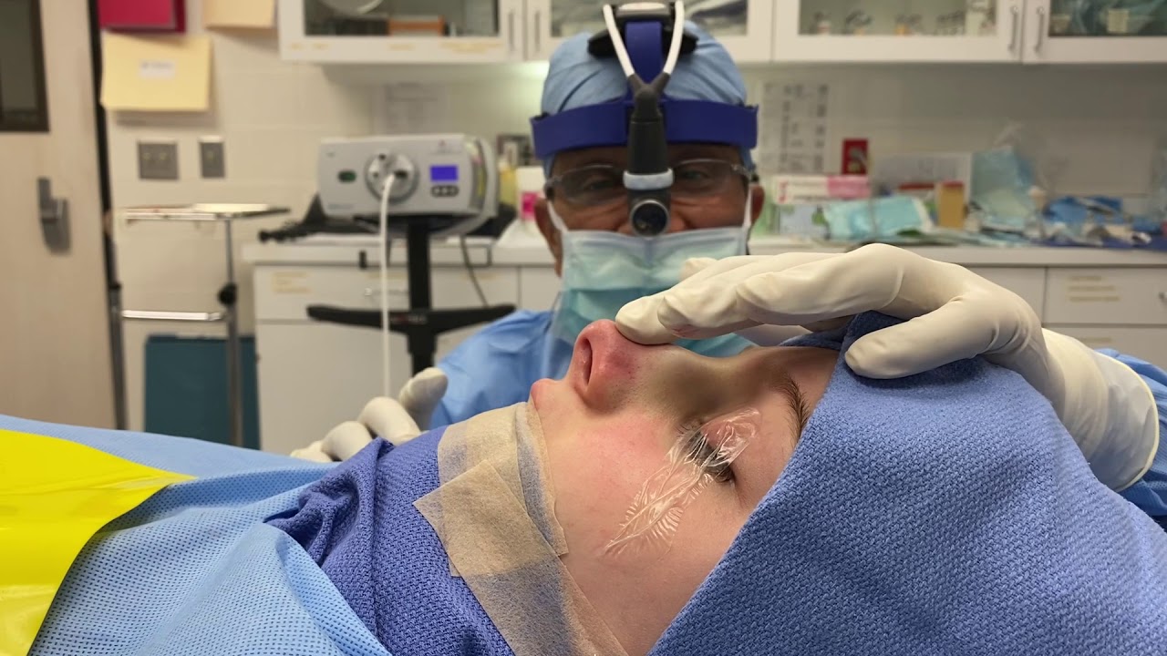 rhinoplastie